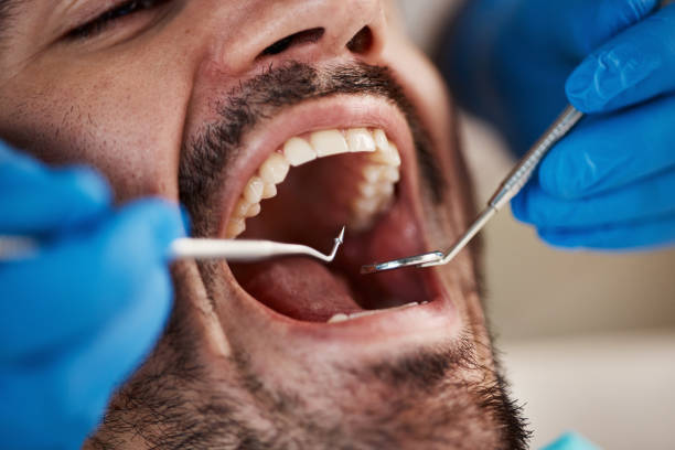 Emergency Dental Services in Beesleys Point, NJ